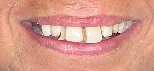 The image shows a person s smiling face with teeth visible, focusing on dental health or cosmetic dentistry services.