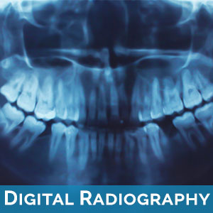 The image shows a dental X-ray with a visible tooth root, positioned against a blue background, accompanied by text that reads  Digital Radiography.