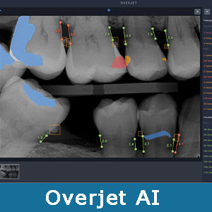 The image shows a computer screen displaying an X-ray with labeled teeth and other dental structures, indicating some form of medical analysis or presentation related to dentistry or dental health.