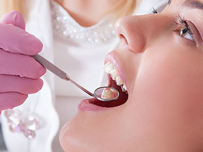 The image shows a dental professional performing a procedure on a patient, with the patient s mouth open and the dentist using a tool to work inside.